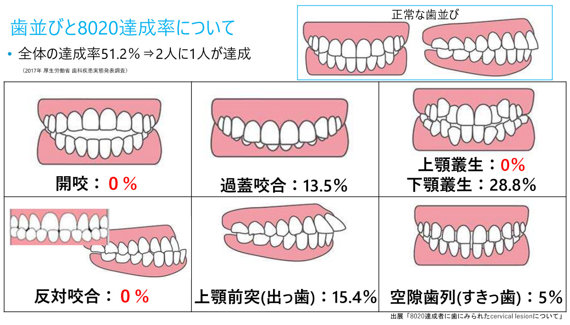 8020運動
